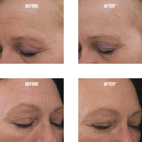 Before and After Webiste Dermatest update-01